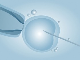 Combien de temps faut-il attendre entre deux cycles de FIV ?